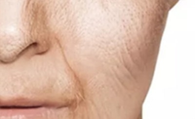 Anti-Wrinkle Neck Cream